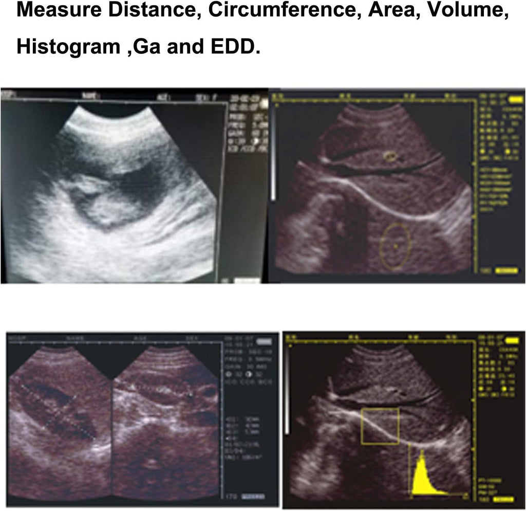 Veterinary Ultrasound Scanner Kit Rechargeable with 3.5MHz Probe J406